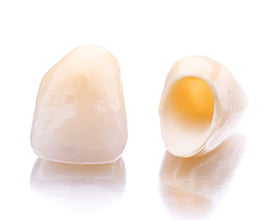 E-max イメージ